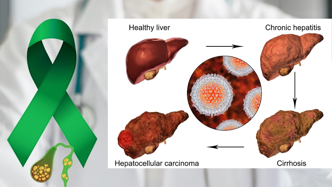 Liver Cancer Symptoms: Causes & Signs